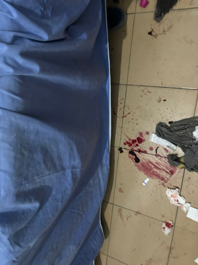 Djiddah Thiaroye Kao/Violences lors de la campagne électorale: Mamadou Guèye, DG des Domaines, victime d'une attaque Djiddah Thiaroye Kao/Violences lors de la campagne électorale: Mamadou Guèye, DG des Domaines, victime d'une attaque