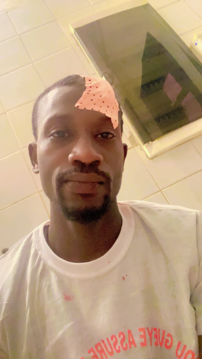 Djiddah Thiaroye Kao/Violences lors de la campagne électorale: Mamadou Guèye, DG des Domaines, victime d'une attaque Djiddah Thiaroye Kao/Violences lors de la campagne électorale: Mamadou Guèye, DG des Domaines, victime d'une attaque