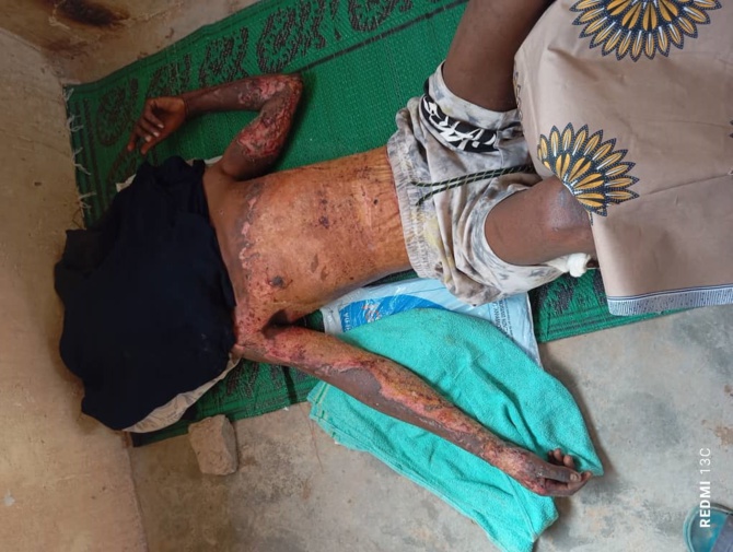 Emigration clandestine-Algérie : Des sénégalais attaqués au cocktail Molotov et au couteau ! (Âmes sensibles s’abstenir HSF) Emigration clandestine-Algérie : Des sénégalais attaqués au cocktail Molotov et au couteau ! (Âmes sensibles s’abstenir HSF)