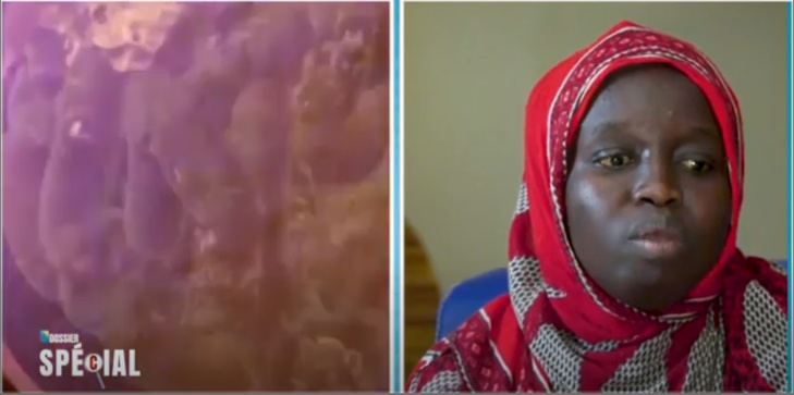 Ndèye Fatou Thiaw, insuffisante rénale: « Personne ne peut supporter le coût de la dialyse et même, avec le soutien des familles » Ndèye Fatou Thiaw, insuffisante rénale: « Personne ne peut supporter le coût de la dialyse et même, avec le soutien des familles »