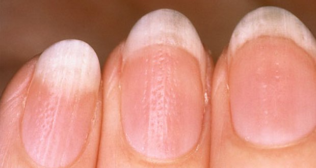 Ce que vos ongles révèlent sur votre santé