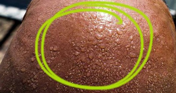 12 signes qui montrent que vous manquez de vitamine D
