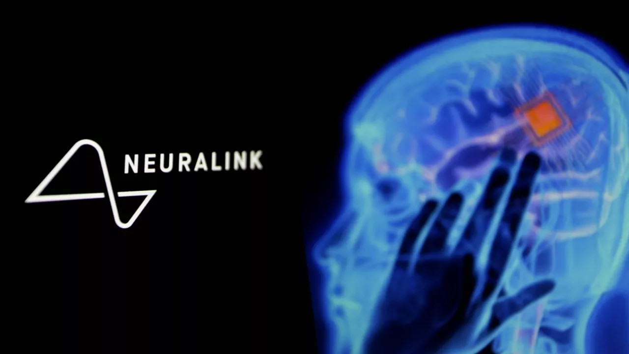 Neuralink : Elon Musk espère implanter « plus de cinq patients » d'ici la fin de l'année Neuralink : Elon Musk espère implanter « plus de cinq patients » d'ici la fin de l'année