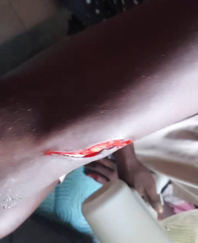 Mbour : Le "Kankourang" de Pa Cissé blesse plusieurs personnes à Thiocé Est 2 Mbour : Le "Kankourang" de Pa Cissé blesse plusieurs personnes à Thiocé Est 2