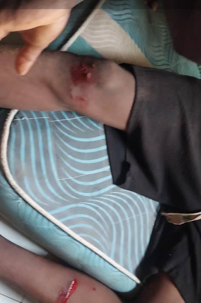 Mbour : Le "Kankourang" de Pa Cissé blesse plusieurs personnes à Thiocé Est 2 Mbour : Le "Kankourang" de Pa Cissé blesse plusieurs personnes à Thiocé Est 2