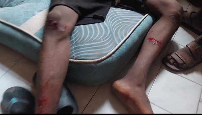 Mbour : Le "Kankourang" de Pa Cissé blesse plusieurs personnes à Thiocé Est 2 Mbour : Le "Kankourang" de Pa Cissé blesse plusieurs personnes à Thiocé Est 2