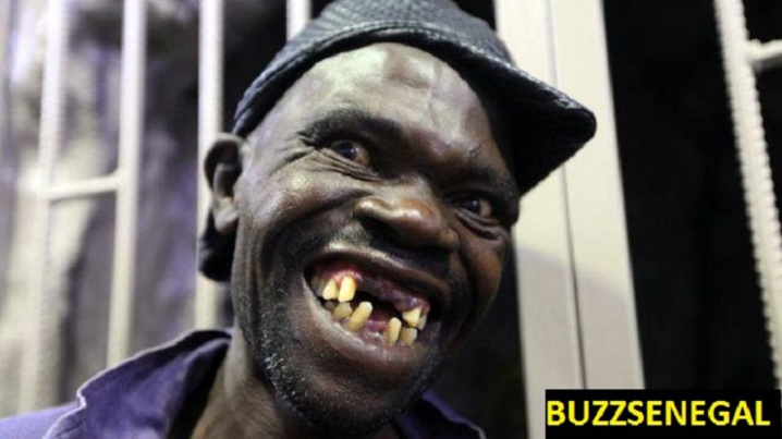Concours d'homme le plus laid....au Zimbabwe 