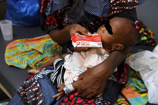 Diourbel face à une crise nutritionnelle : plus de 50 000 enfants en danger