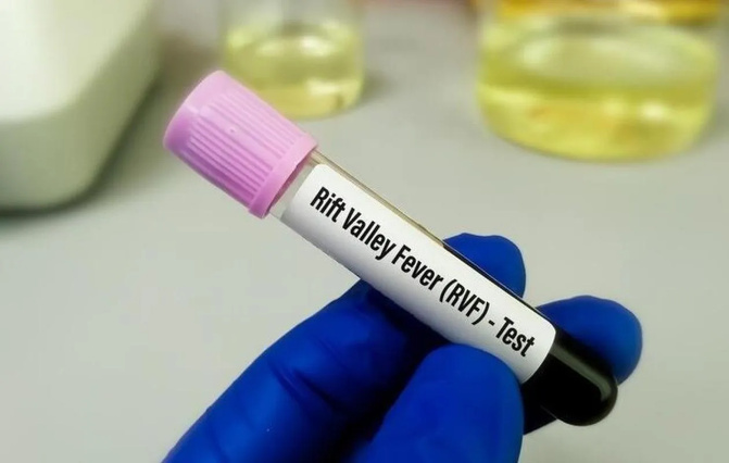 Santé : 277 cas de fièvre de la Vallée du Rift et 7 cas de Mpox recensés au Sénégal