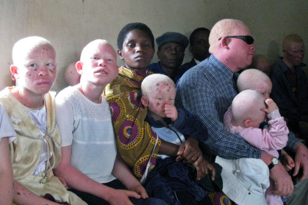 Horreur - Arrestation de dix Malawites soupçonnés du meurtre d’une Albinos