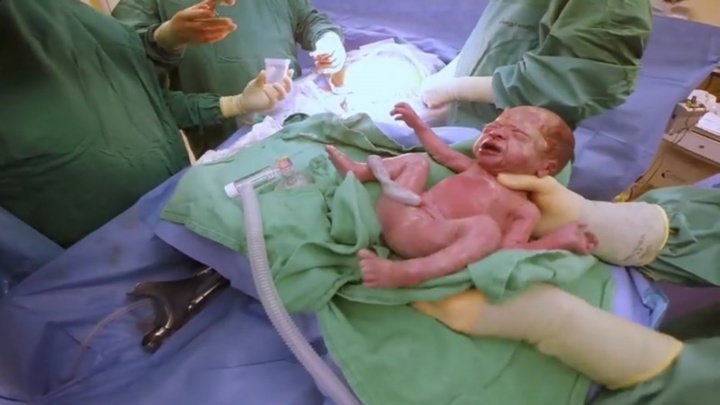 Une mère attendait des jumeaux normaux, mais lorsque les médecins lui ont montré cette photo, elle a eu le souffle coupé.