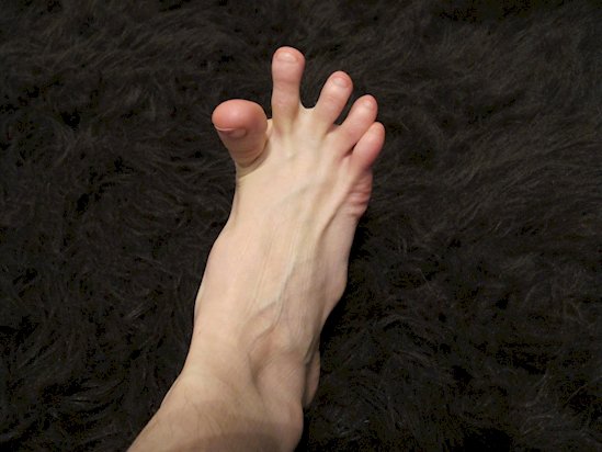 Voici pourquoi vous avez de brusques crampes dans les pieds !