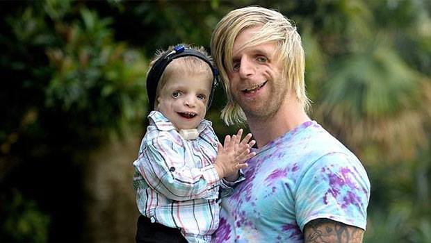 Il va en Australie pour rencontrer un petit garçon au visage déformé. Le message qu’il fait passer est rempli d’espoir.