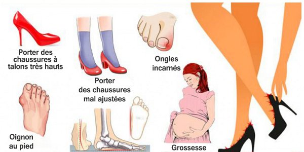 Causes des douleurs aux pieds et comment y remédier