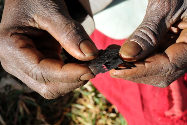 140 millions de femmes sont excisées à travers le monde, selon la présidente du réseau des femmes parlementaires de la Mauritanie