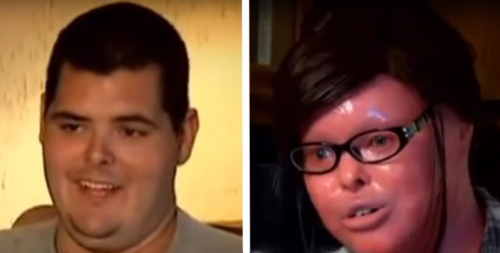 Née avec une maladie rare, cette Américaine vit 3 miracles en 20 ans