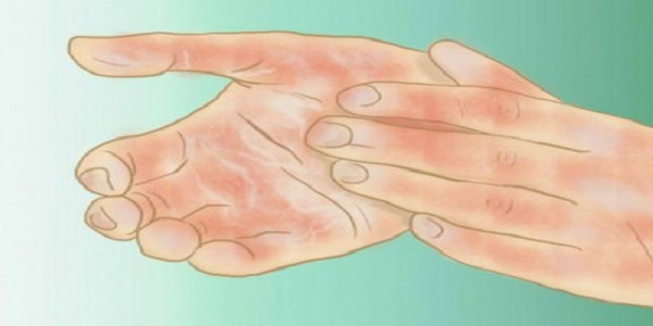 Voici pourquoi vous avez les mains et les pieds froids et comment y remédier
