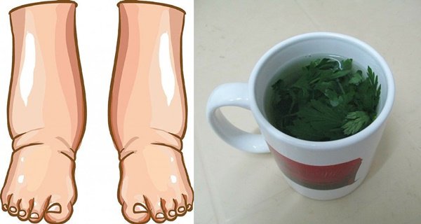 Cet excellent thé est le meilleur remède naturel contre les jambes enflées
