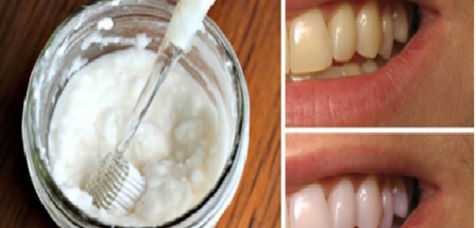 Comment blanchir les dents en 2 minutes