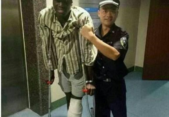 Opéré vendredi dernier, Demba Bâ quitte l’hôpital ce jeudi matin