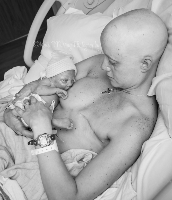 Une mère qui a le cancer du sein allaite son nouveau-né
