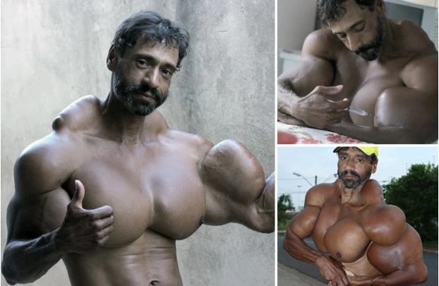 Valdir Segato, ce bodybuilder brésilien est incroyable, il s'injecte de l'huile dans les muscles, on dirait HULK.