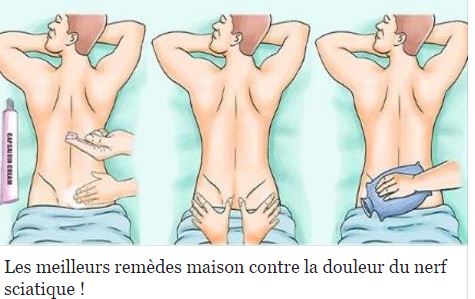 Les meilleurs remèdes maison contre la douleur du nerf sciatique !