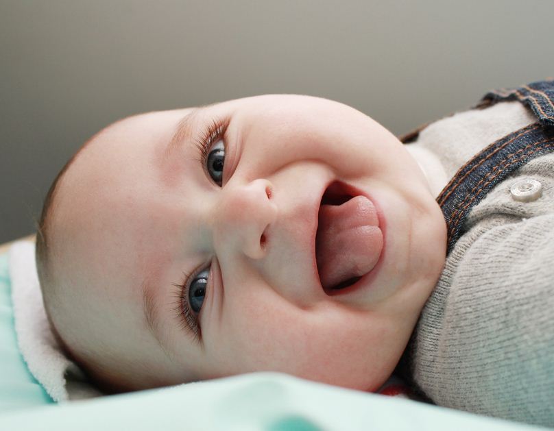 Atteint D Un Syndrome Rare Un Bebe Nait Avec Une Langue Disproportionnee Atteint D Un Syndrome Rare Un Bebe Nait Avec Une Langue Disproportionnee