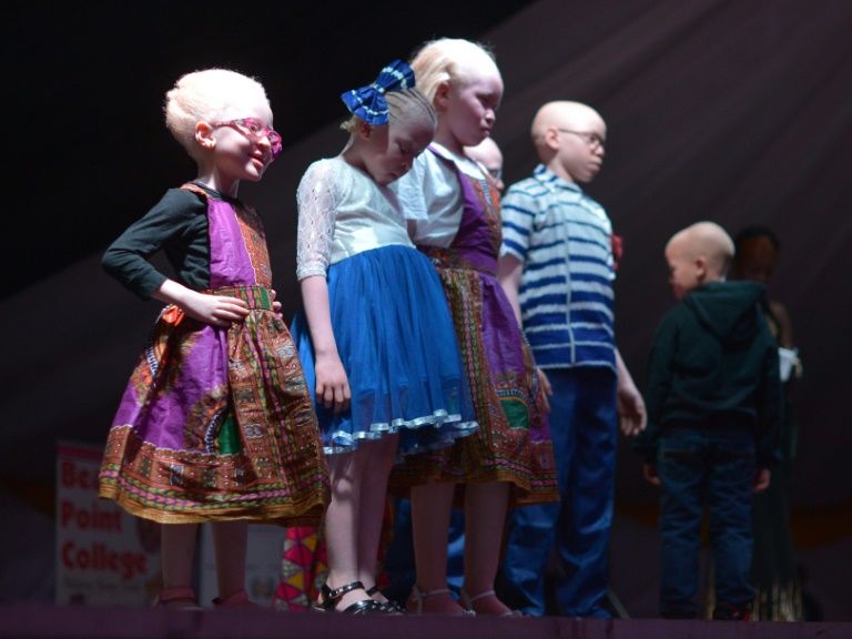 Des enfants albinos