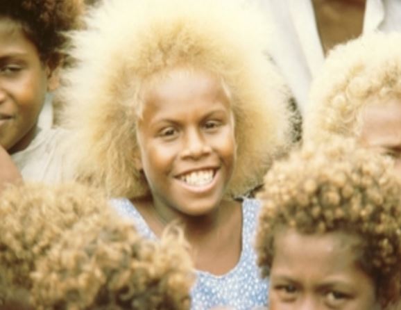 ​Insolite : Les Mélanésiens, ces noirs aux cheveux blonds (photos)