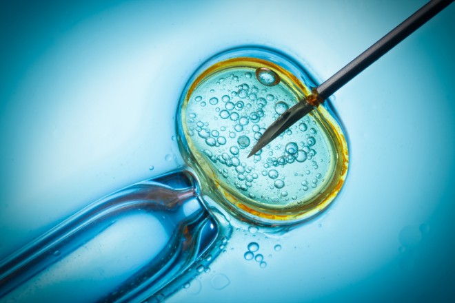 26 femmes potentiellement inséminées avec le mauvais sperme :Des ovocytes fécondés avec un sperme qui n'appartenait pas forcement à leur compagnon