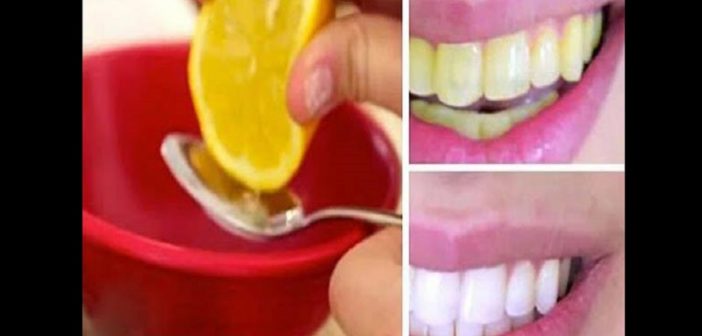 Astuce: voici comment avoir des dents blanches en quelques minutes