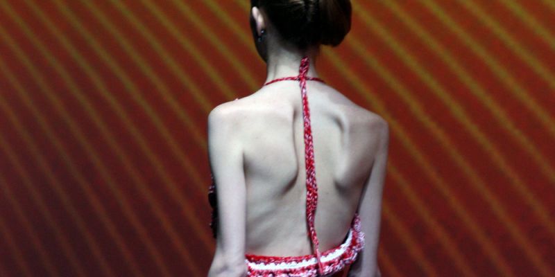 La loi mannequin contre l'anorexie, enfin publiée