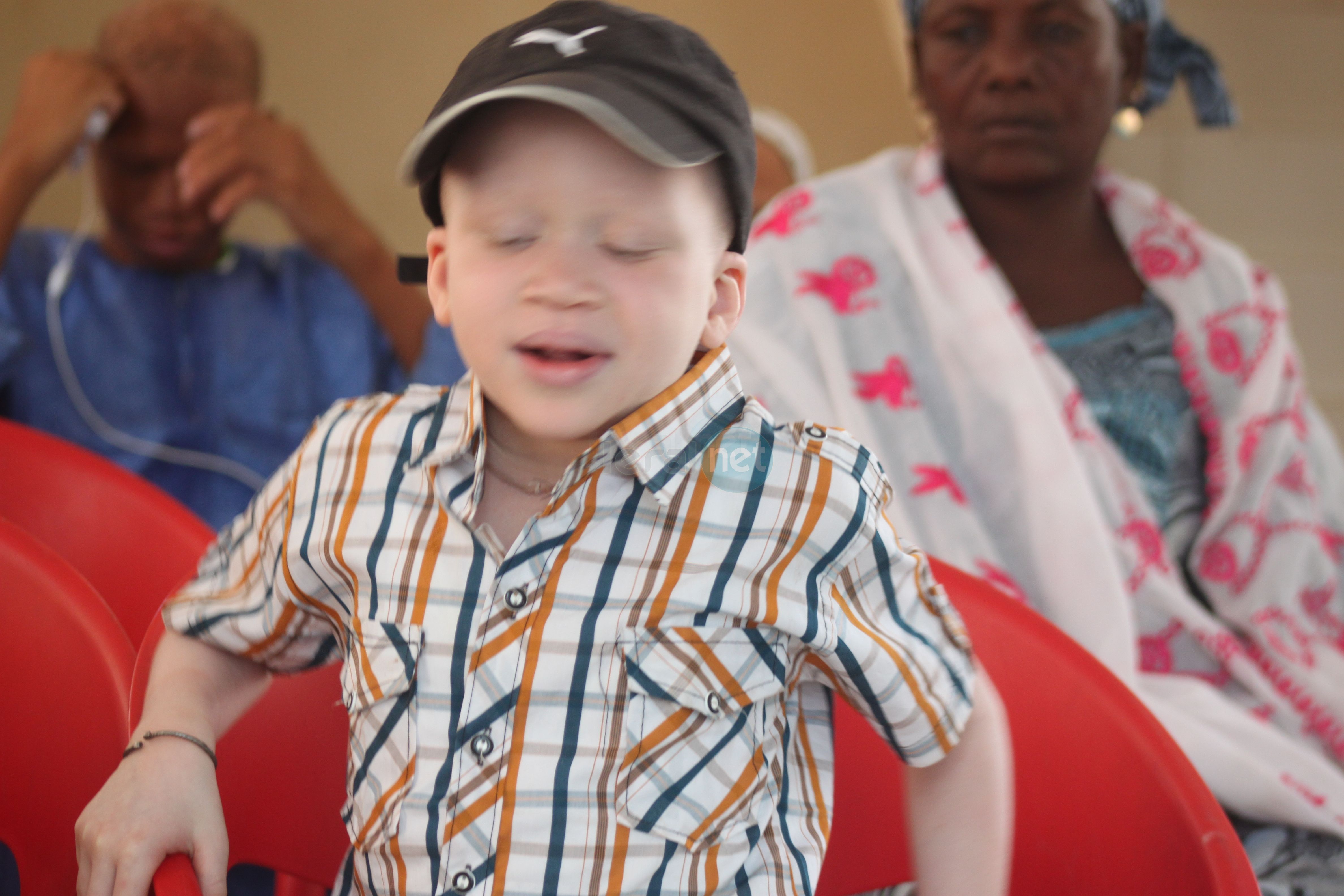 Les Petites Gouttes ont fêté l’anniversaire du projet Albinisme : Un An sous le Parasol, 2e édition