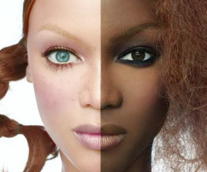 Dépigmentation volontaire : un phénomène de société et un problème de santé publique