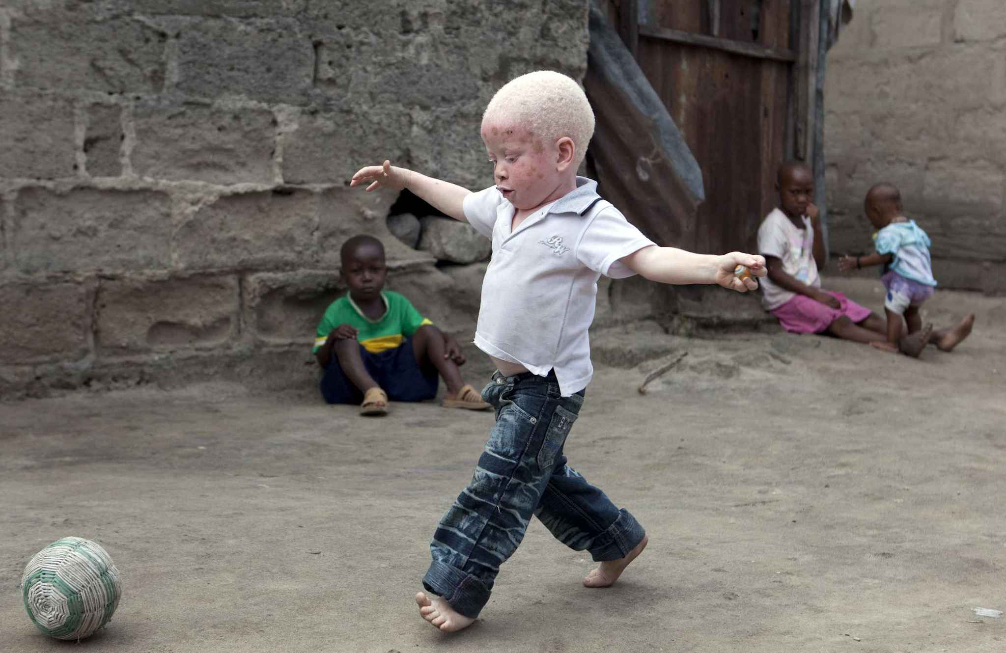 Élection législative de juillet prochain: La grande peur des albinos