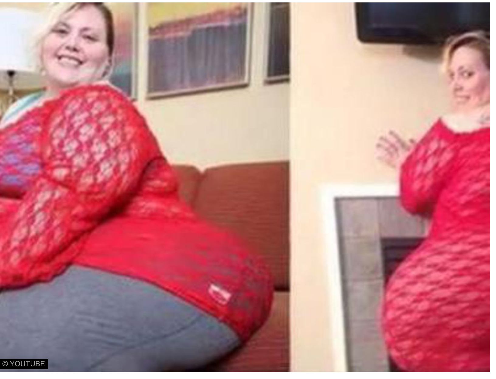 Obèse, cette femme veut Obèse, cette femme veut