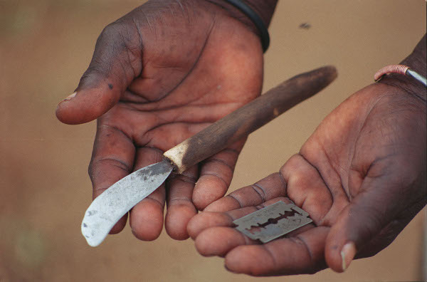 Mutilations génitales féminines au Sénégal : 13 % des filles de moins de 15 ans sont excisées