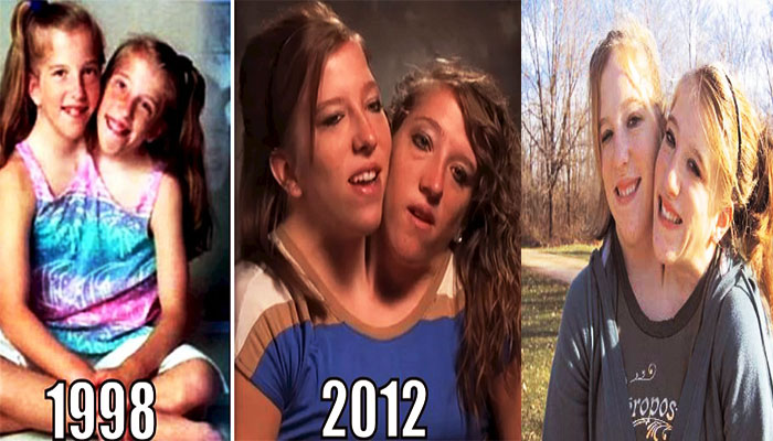 Abigail et Brittany, les célèbres soeurs siamoises, sont devenues profs : voici comment se déroulent leurs cours (