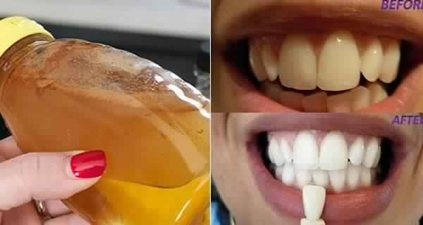 Voici comment éliminer la plaque, le tartre et les mauvaises bactéries dans la bouche