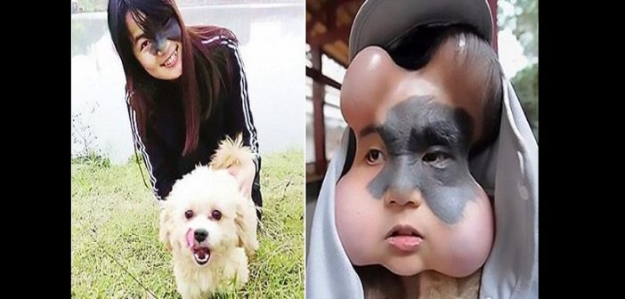 Chine: 4 ballons implantés dans le visage d’une femme pour sauver sa vie
