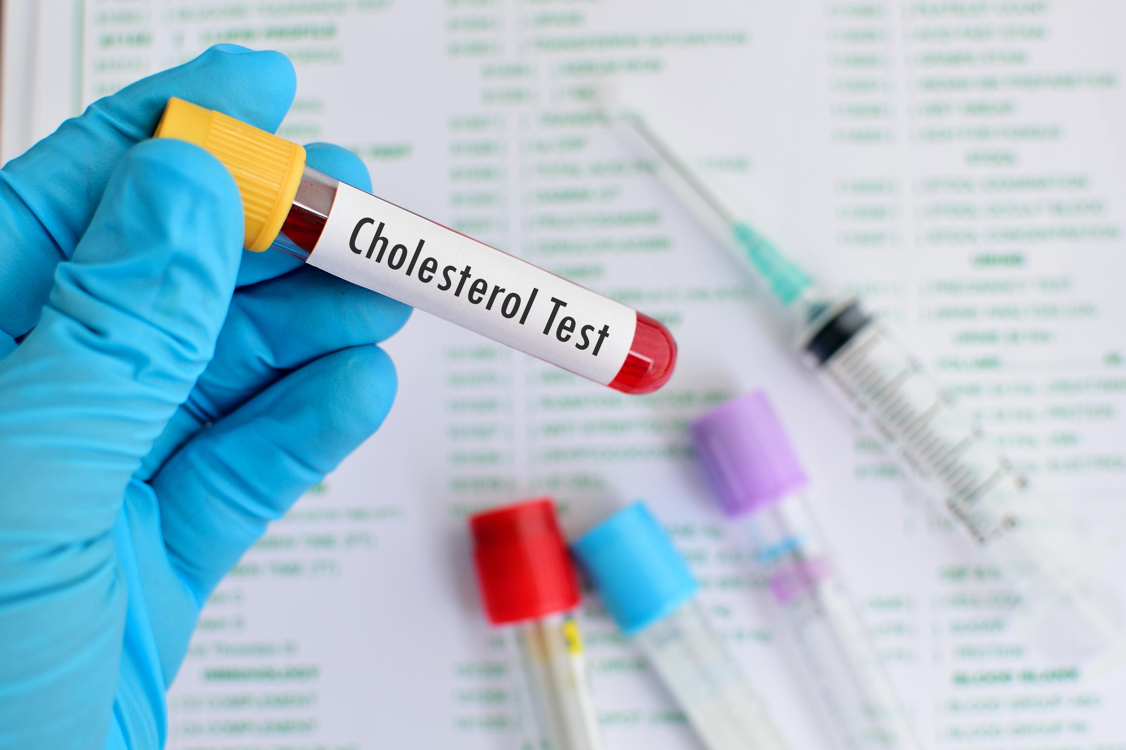 Le Cholestérol - Ce que vous pouvez faire pour abaisser votre taux.