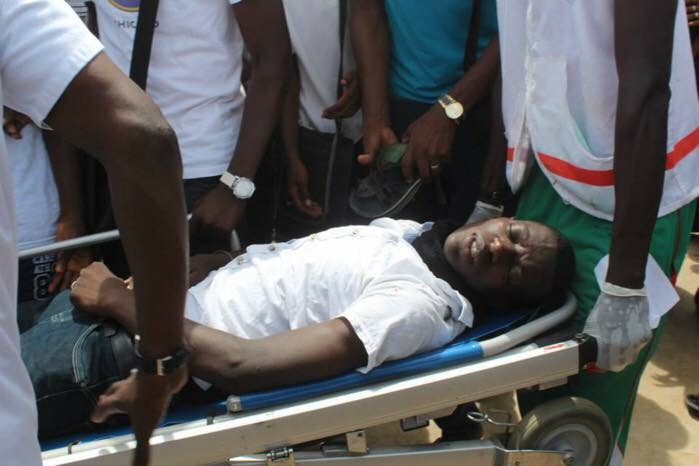 Photos : Cet homme serait celui qu'on a annoncé comme mort, mais, il aurait reçu juste un caillou