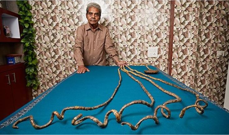 L'homme aux ongles les plus longs du monde a fini par les couper (vidéo)