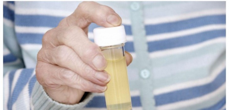 Infection urinaire: causes et symptômes