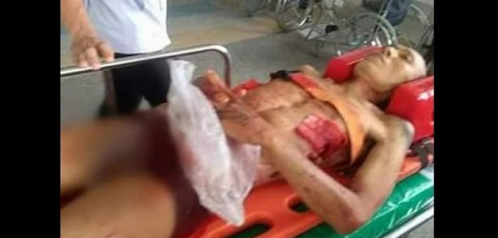 Thaïlande : Fatigué d’être rejeté par les femmes, il se coupe le pé××is (photos)