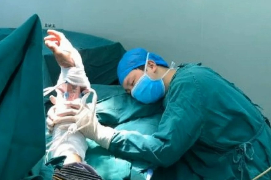 Arrêt sur image - Exténué, un chirurgien s'endort en tenant le bras de son patient