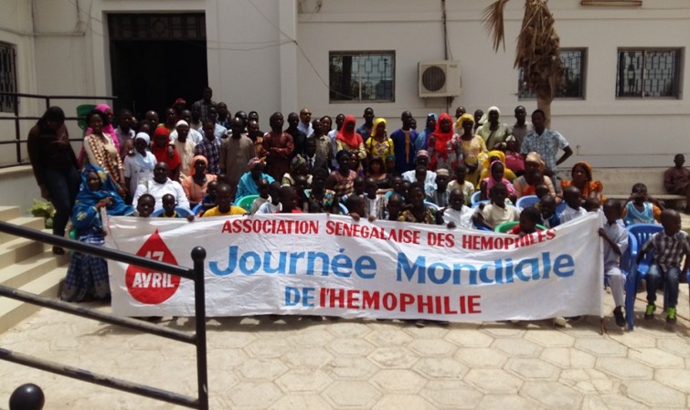 Santé : 239 cas d'hémophiles recensés au Sénégal