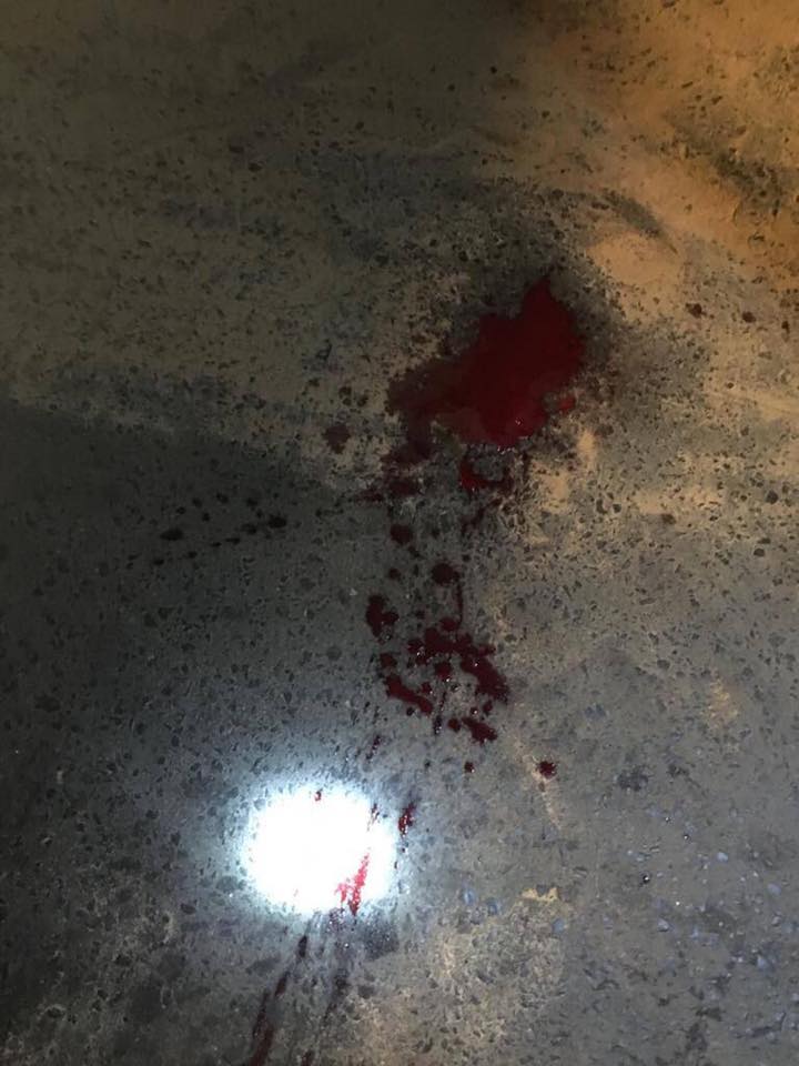 Un conducteur d'un 4x4 L200 Hillux DK 4729 BH agresse sauvagement un chauffeur de taxi  Un conducteur d'un 4x4 L200 Hillux DK 4729 BH agresse sauvagement un chauffeur de taxi