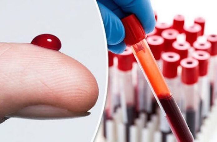 INCROYABLE ! Un nouveau test sanguin créé pour prédire la mort